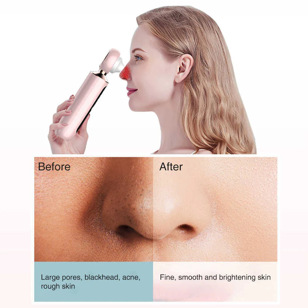 SouqNova™ Blackhead Suction Machine