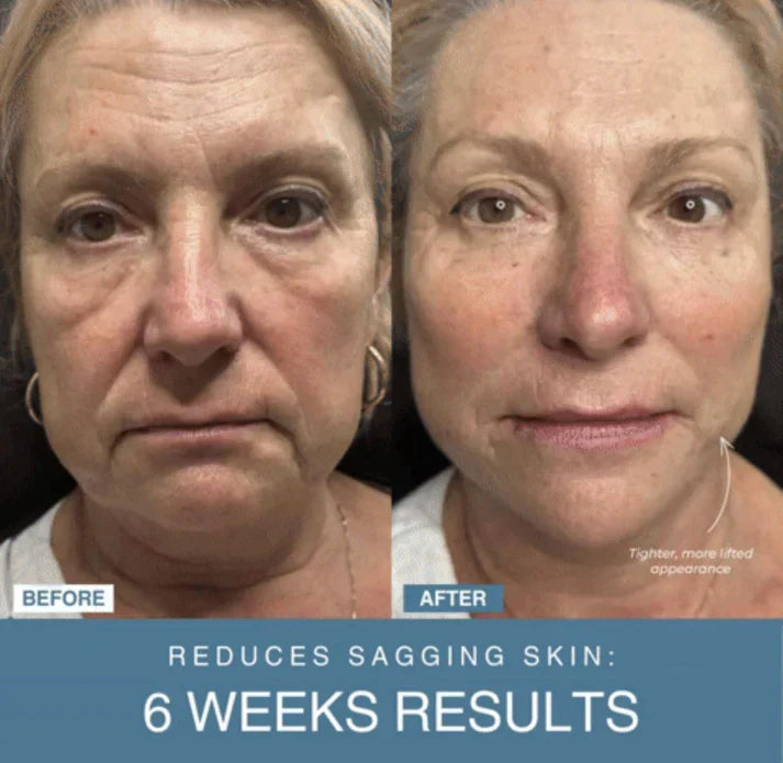 SouqNova™ 7-in-1 LED Anti-Aging/Wrinkle Apparatus