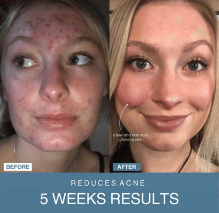 SouqNova™ 7-in-1 LED Anti-Aging/Wrinkle Apparatus