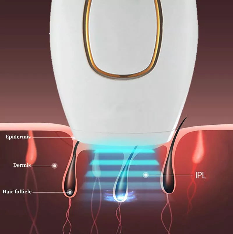 SouqNova™ IPL Laser Hair Removal – جهاز إزالة الشعر بالليزر IPL